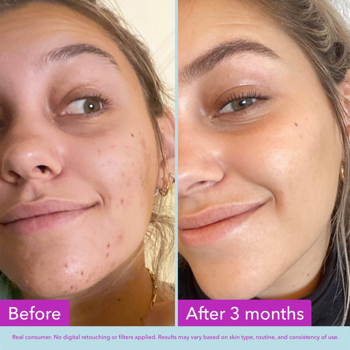 niacinamide-brightening-toner-h3 zb_p.jpg