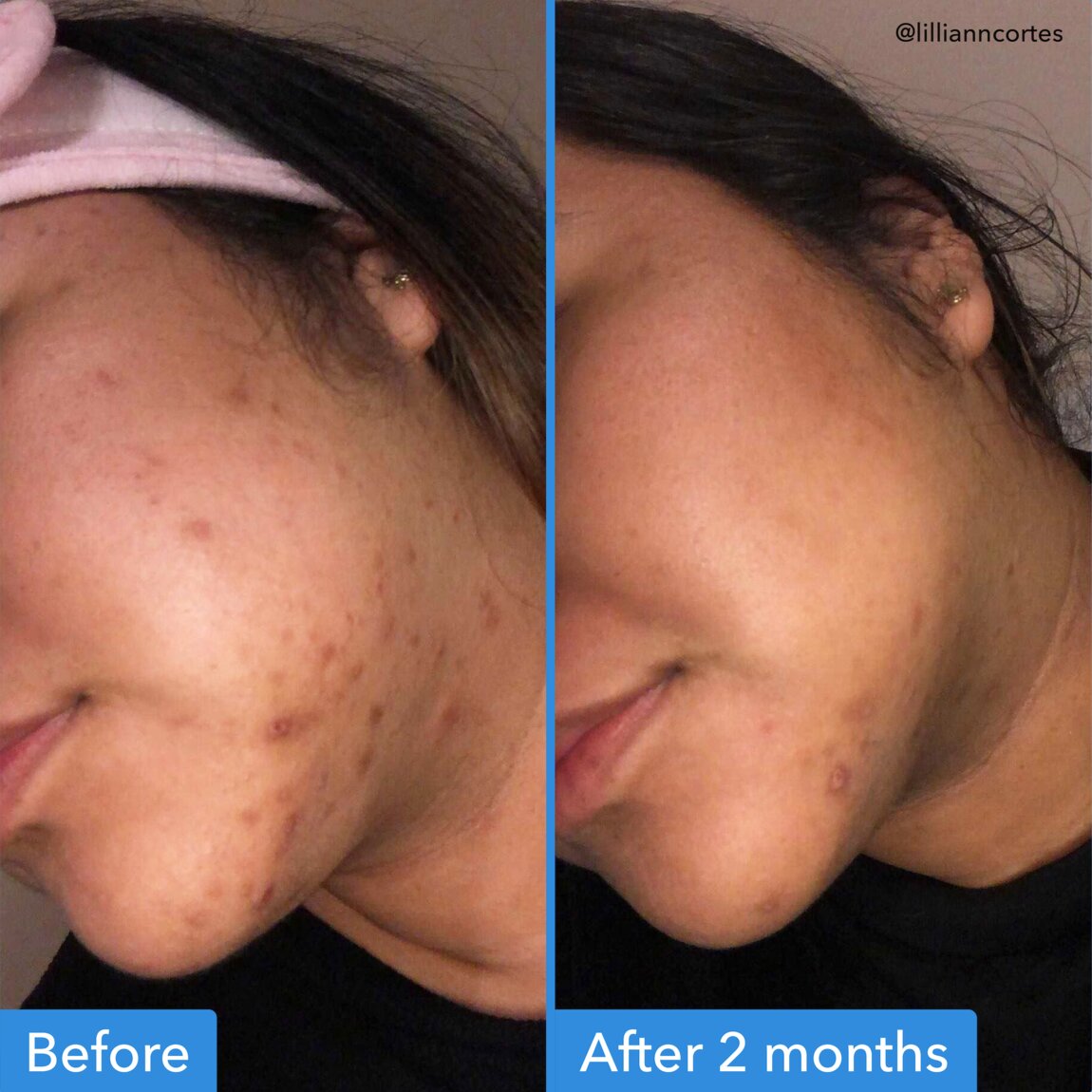 discoloration-correcting-serum-u1 zb_p.jpg
