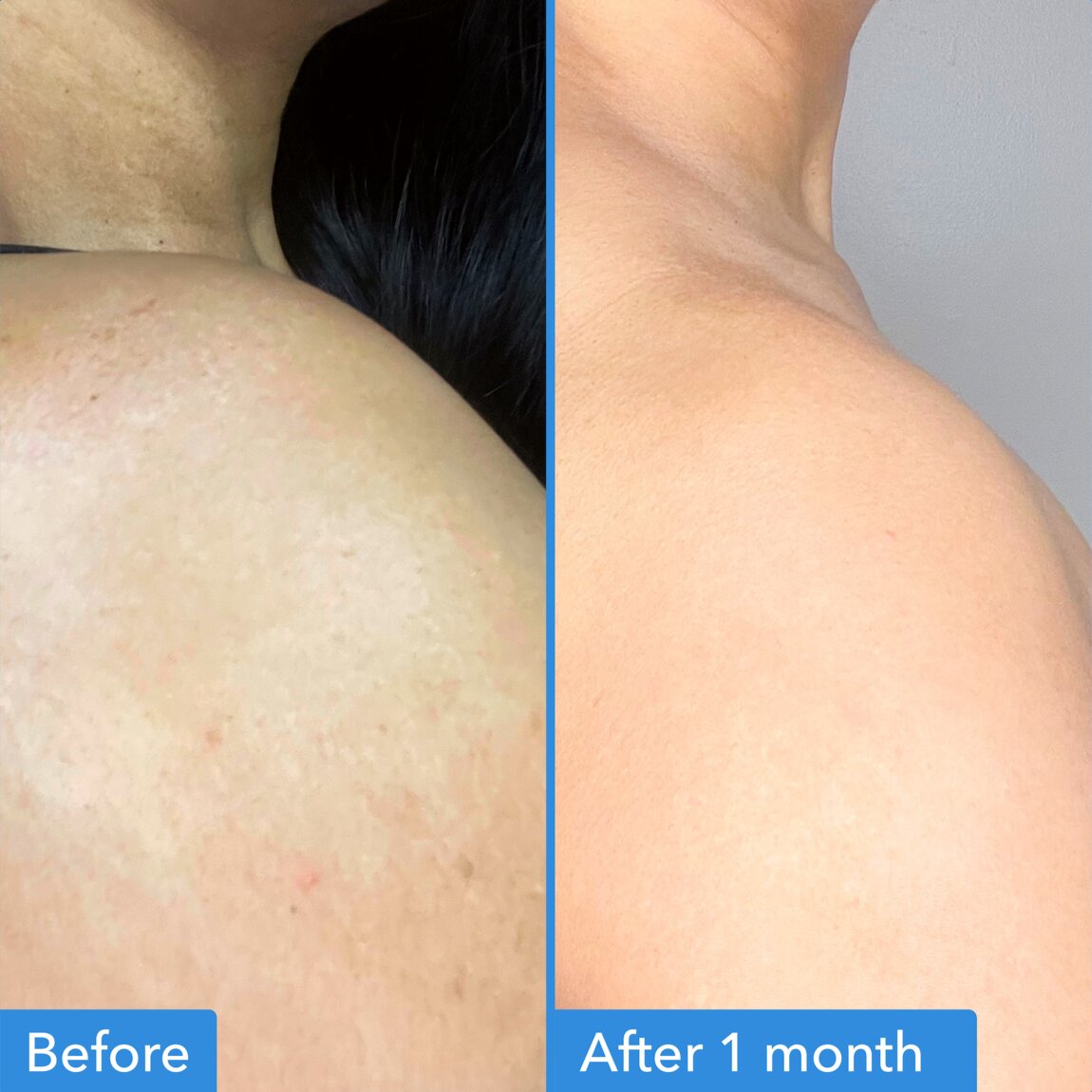 discoloration-correcting-body-treatment-y6 zb_p.jpg